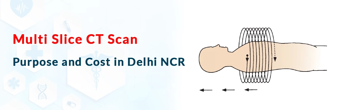 Multi Slice CT Scan: Purpose and Cost in Delhi NCR